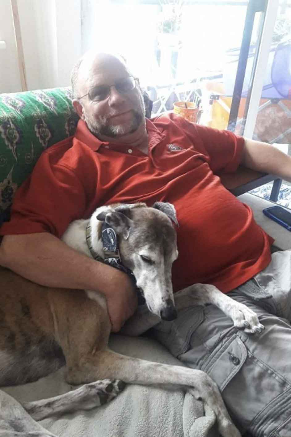 Randy Livingston in 2017, 30lbs heavier, before receiving his Inspire Implant Randy Livingston in 2017, 30lbs heavier, before receiving his Inspire Implant